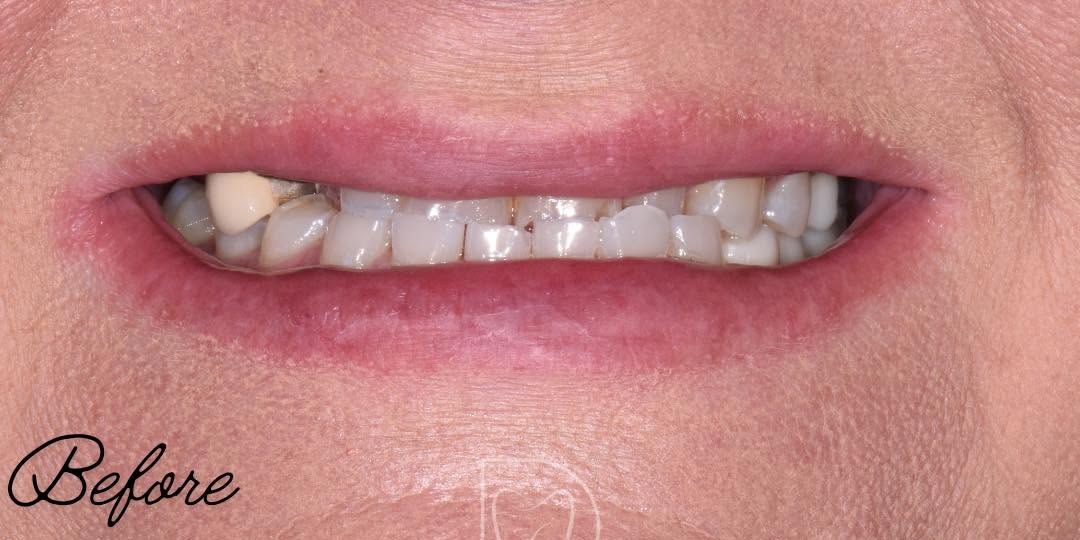 Before treatment